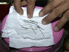 Diobati Paranormal, 20 Jarum Keluar dari Kepala Pemuda Asal Blitar