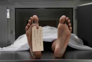 Wah, Ada Gen yang Dapat Memperkirakan Jam Berapa Orang akan Meninggal