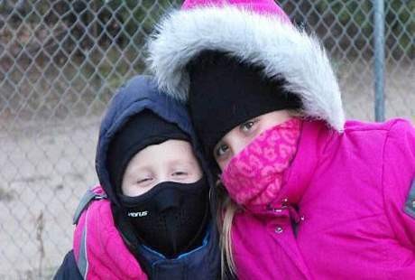 Kakak Beradik Asal AS Ini Alergi Udara Dingin yang Langka