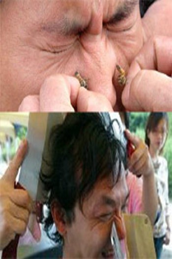 Iiih! 5 Pengobatan Ini Bikin Merinding