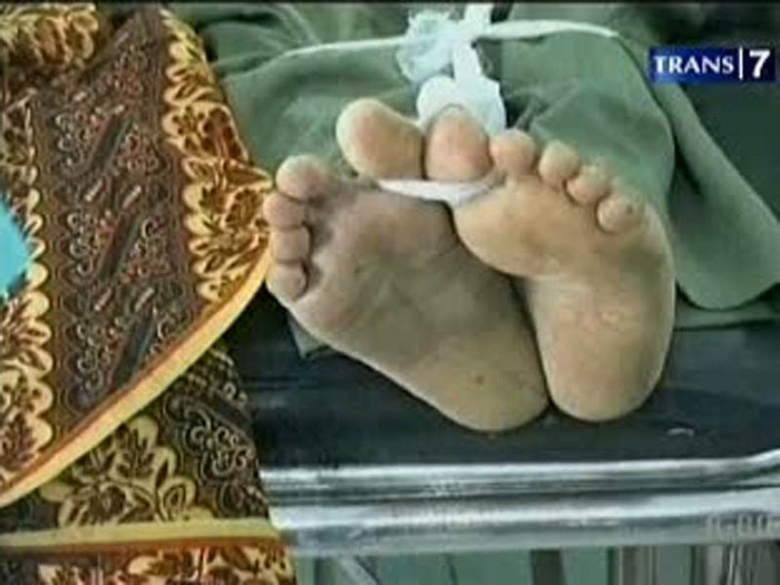 PNS Tewas Saat Kencan dengan Selingkuhan