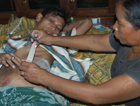 Usus Menyembul Keluar, Iwan Fals Dirawat Ibunya di Rumah