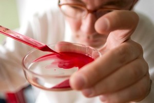 Bocah 7 Tahun Ini Sembuh dari Leukemia Berkat Rekayasa Sistem Imun