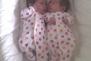 Waduh! Baru Umur 11 Hari Bayi Kembar Ini Sudah 12 Kali Patah Tulang
