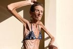 Valeria Levitin, Wanita Paling Kurus di Dunia
