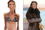 Valeria Levitin, Wanita Paling Kurus di Dunia
