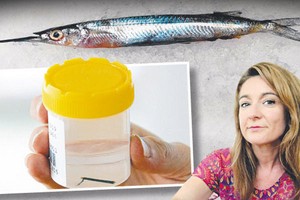 Telinga Tertusuk Ikan Terbang, Turis Australia Nyaris Tuli