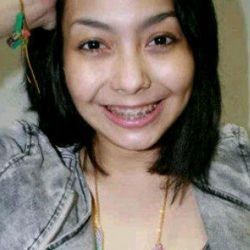 Kisah Cecillia Vickend Berjuang Lawan Kanker Lidah