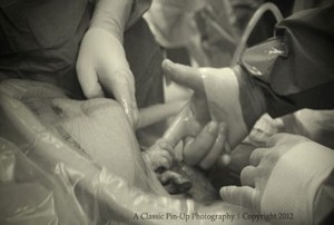 Wah! Akan Dilahirkan, Bayi dalam Kandungan Ini Pegang Jari Pak Dokter