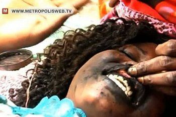 Proses Bikin Tato Gusi ala Gadis-gadis Cantik di Afrika