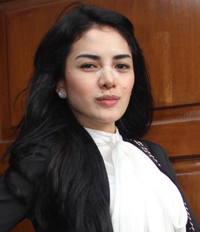 Hadiri Sidang, Hidung Nikita Mirzani Masih Ada Bekas Operasi