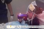 Parah! Ini Jadinya Kalau Lidah Terjepit Mulut Botol