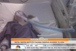 Parah! Ini Jadinya Kalau Lidah Terjepit Mulut Botol