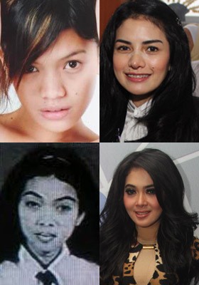 Benarkah 5 Selebriti Indonesia Ini Operasi Plastik?