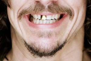 Kumis Berjamur? Idiih.. Amit-amit
