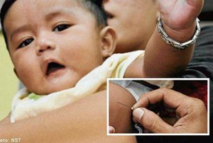 Duh! Ada Jarum Tertanam di Paha Bayi