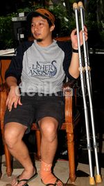 Duh, Kaki Ringgo Agus Rahman Patah