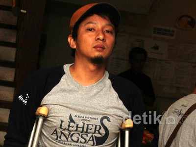 Duh, Kaki Ringgo Agus Rahman Patah