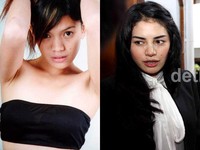 Saat menghadiri sidang perdana kasus pemukulan Olivia Mai Shandie di PN Jakarta Selatan, Nikita Mirzani hadir dengan hidungnya yang baru saja di operasi agar terlihat lebih cantik. (Facebook; detikHOT)