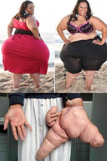 Orang-orang Ini Punya Organ Tubuh Terbesar di Dunia