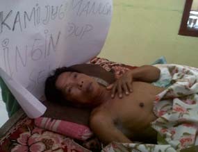 Hudri, Pria Lumpuh di Pasuruan Dijamin Pemerintah Bisa Berobat Gratis