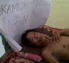 Hudri, Pria Lumpuh Asal Pasuruan Hanya Dapat bantuan Rp 1 juta. Operasi Tetap Bayar