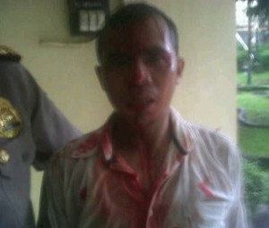 Petani & Polisi Bentrok di Mapolda Sumsel, Direktur Walhi Sumsel Terluka