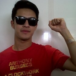 Ini Bekas Luka Morgan SM*SH Usai Kecelakaan