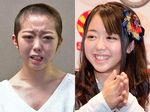 Tersandung Skandal Seks, Minami Minegishi AKB48 Gunduli Rambut