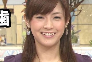 Di Jepang, Gigi yang Cantik adalah yang Mirip Vampir