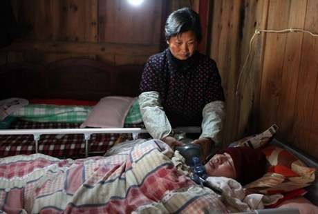 Tak Mampu Bayar Ventilator, Paru-paru Pemuda Ini Dipompa Pakai Tangan