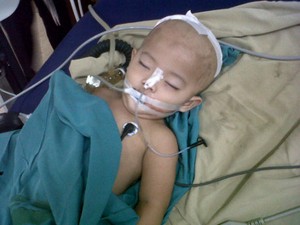 Bayi 1 Tahun Kritis Terkena Peluru Nyasar di Bagian Kepala