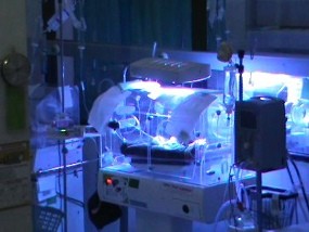 Bertahan 10 Jam, Kembar Siam asal Bojonegoro Meninggal Dunia