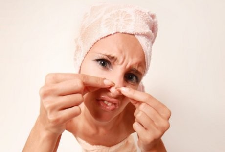 Ilmuwan Pastikan Susu dan Makanan Manis Bikin Jerawatan