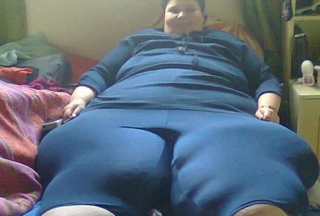 Gara-gara Digigit Nyamuk, Tubuh Sophia Membengkak Hingga 228 Kg