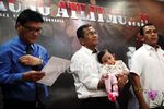 Dahlan Iskan Gendong Anak Penderita Kerapuhan Kulit