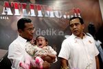 Dahlan Iskan Gendong Anak Penderita Kerapuhan Kulit