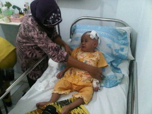 Sempat Koma, Bocah 2,5 Tahun yang Dianiaya Bibinya Kini Alami Kebutaan