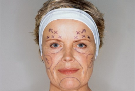 Operasi Plastik Favorit Wanita: Dari Payudara Hingga Kelopak Mata