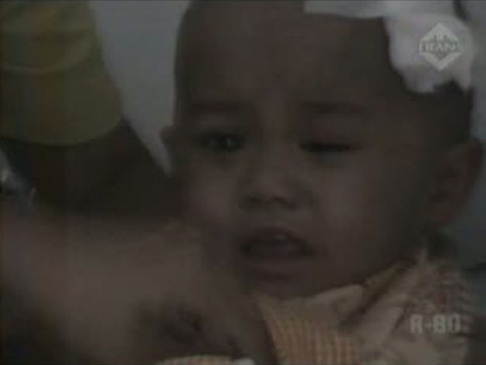 Balita 2,5 Tahun Dianiaya Bibinya Hingga Buta