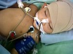 Terkena Peluru Nyasar, Bayi Fatir Meninggal