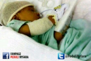Terkena Penyakit Atresia Bilier, Bayi Nyfara Butuh Uluran Tangan