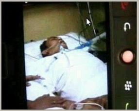 Setahun Terserang Diabetes & Stroke, Tata Dado Terbaring Lemah di Tempat Tidur