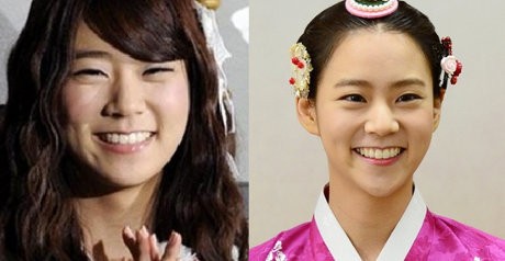 Dagu Berubah Bentuk, Seungyeon KARA Dituduh Operasi Plastik
