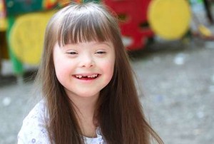 Jangan Dijauhi, Anak dengan Down Syndrome Bukan Kutukan