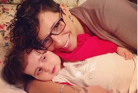 Penyakit Misterius Mengubah Bocah Ini Menjadi Batu