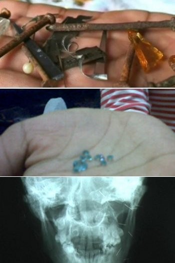 Fenomena Berbau Mistis yang Pernah Ditangani Dokter Indonesia