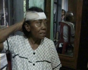 Lindungi Tiga Cucu Dari Angin Puting Beliung, Buari Dapat Tujuh Jahitan di Kepala