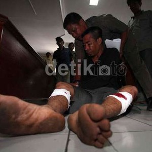 Mencoba Kabur, Pemerkosa Guru SD di Ciputat Ditembak di 2 Betis