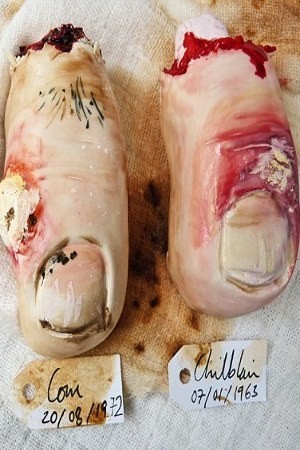 Hiii! Cake Ini Persis Potongan Jari Kaki dan Telinga!